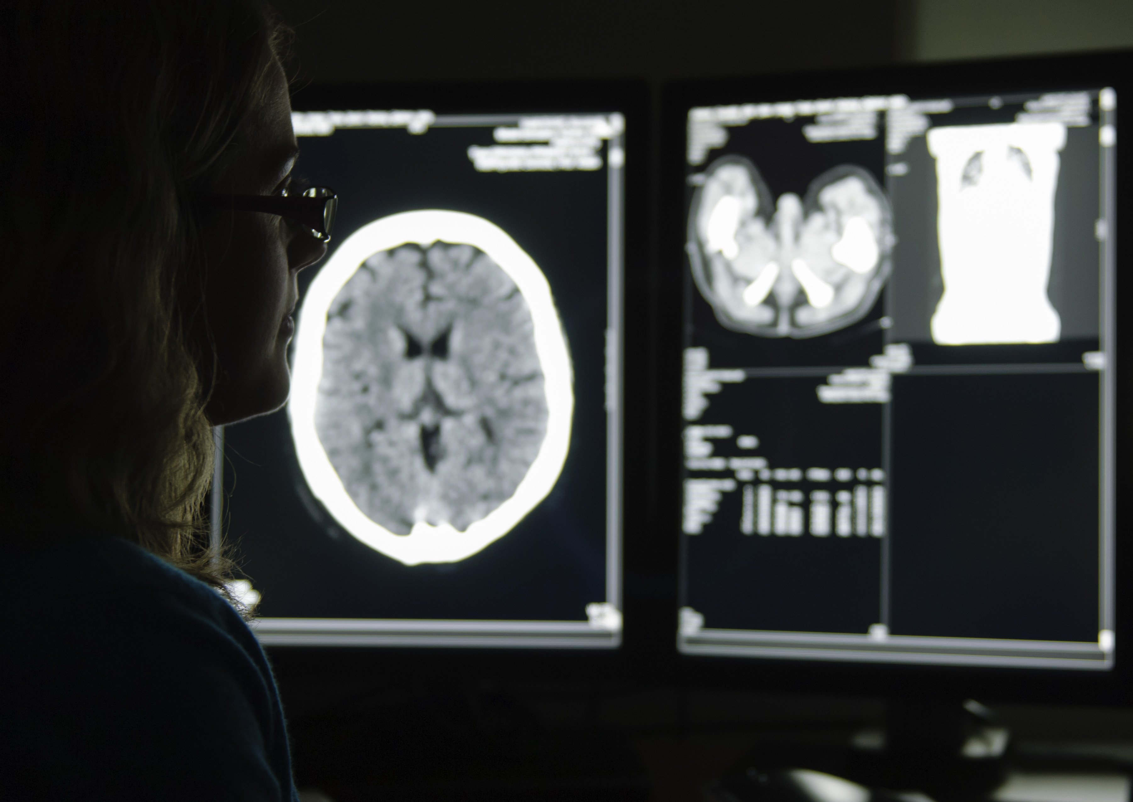 A person in a dark room looking at brain scans