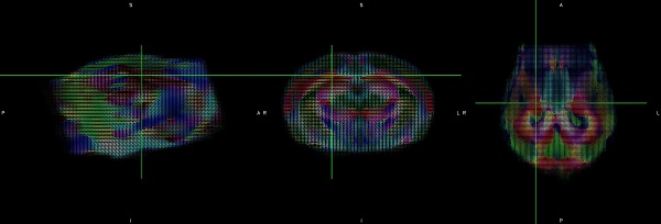 MRI diffusion tensor imaging reveals white matter changes in the brain across genotypes