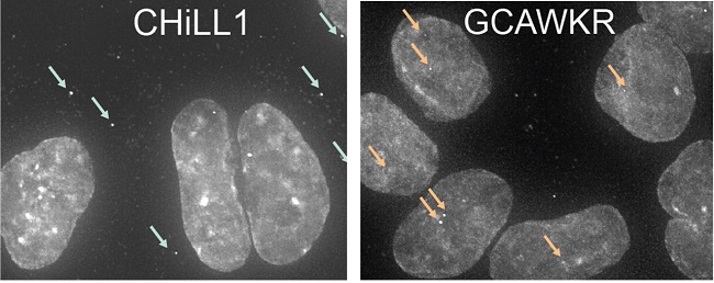 Newly-discovered long noncoding RNA molecules in lung cancer cells.