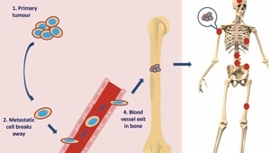 Graphic showing process of cancer cells moving in the body
