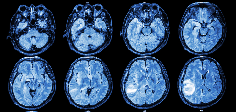 Medical Imaging / Nuclear Medicine