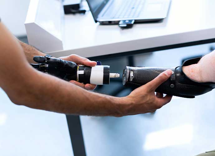 A person helps attach a prosthetic hand to another person's prosthetic arm socket, with a laptop on a desk in the background.