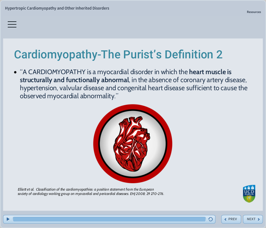 cardiomyopathy