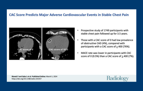 Congratulations to Prof Jonathan Dodd and team on Coronary Artery Calcium Score important prediction research