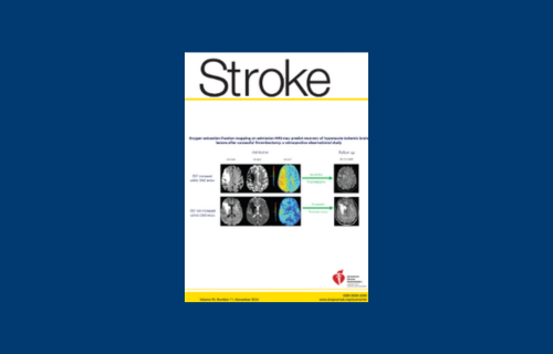 A new blood test for inflammation that helps to identify patients who may be at increased risk of future stroke and heart disease