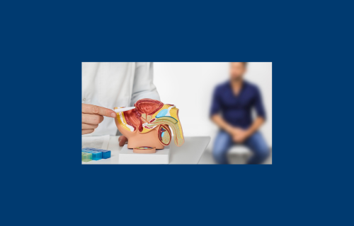 Prostate cancer pilot screening study begins in Ireland as part of an EU initiative to reduce death from prostate cancer across the EU