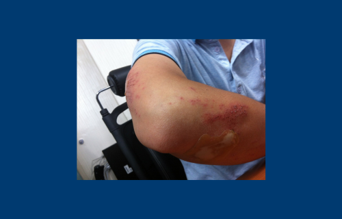 How good are clinicians at diagnosing elbow injuries from paediatric elbow radiographs alone?