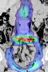 Medical Physics