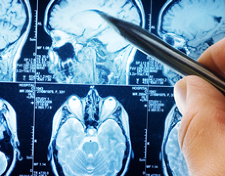 A key strength of UCD’s Biomedical Engineering research activity is its collaboration with clinicians in UCD’s teaching hospitals. This engagement ensures that research addresses and is relevant to real clinical needs, leading to the development of innovative applications and clinical use.\n