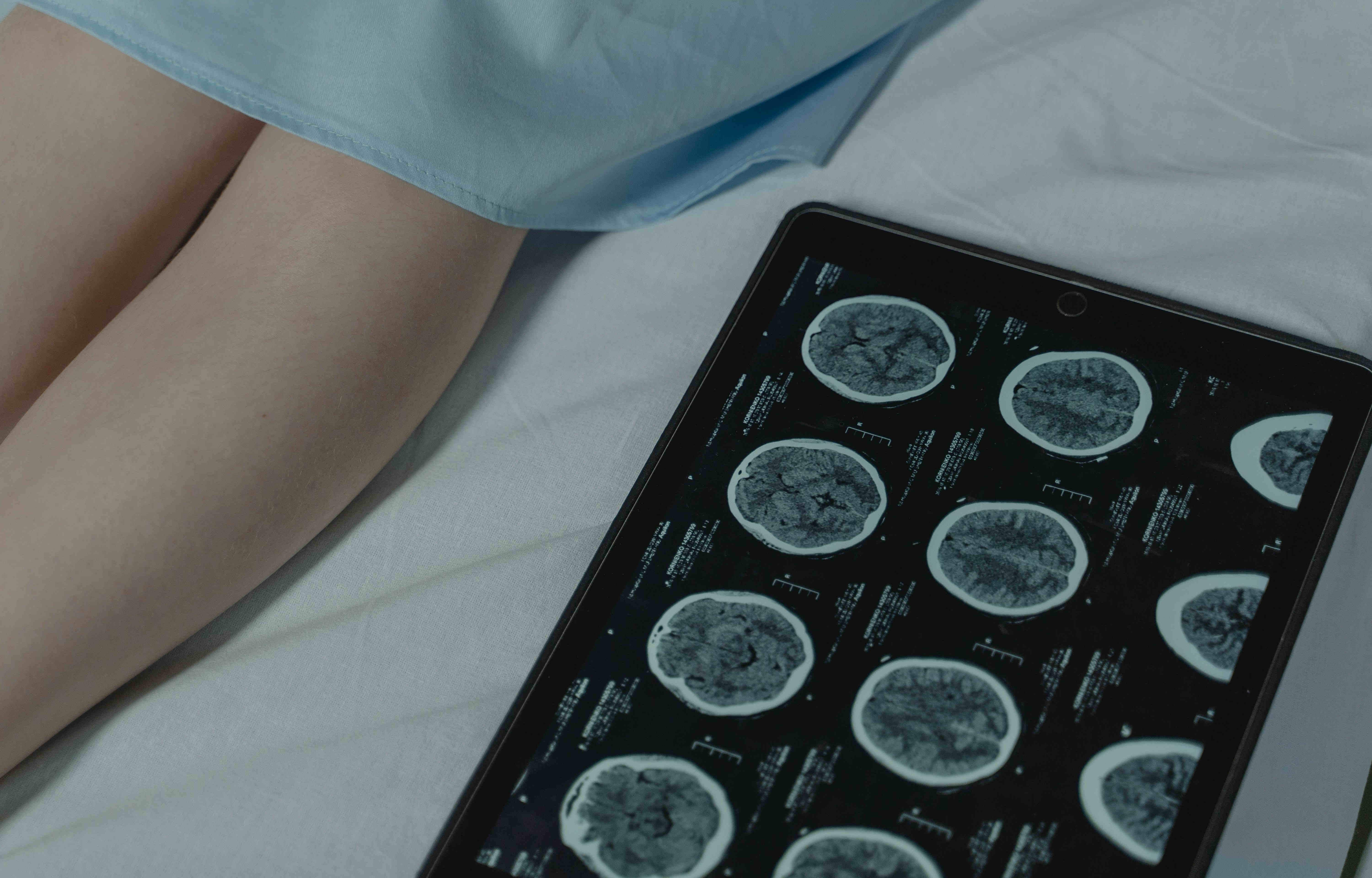 Improving outcomes of critically-ill patients with acquired brain injury.
