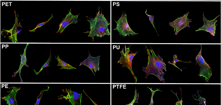 A lab image representing cancer identification